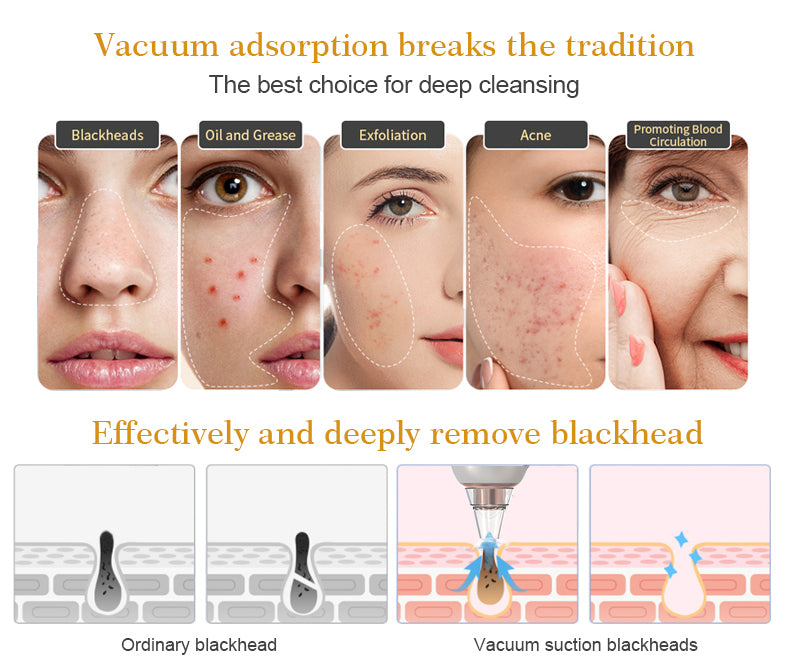 Blackhead Remover Vacuum
