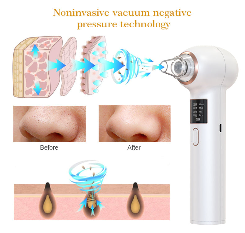 Blackhead Remover Vacuum